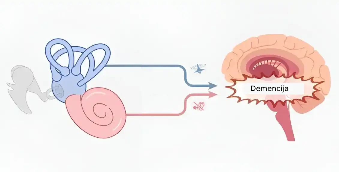 Rezultati novih studija pokazuju da problemi sa vestibularnim sistemom povećavaju rizik od demencije