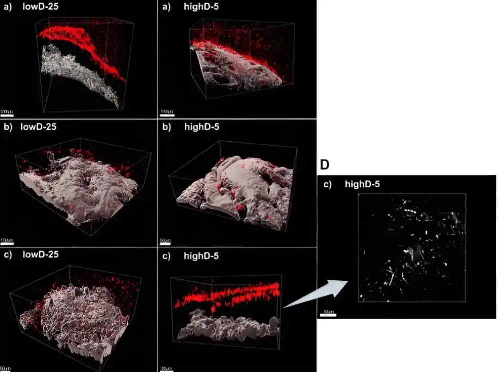 Studija naglašava dugotrajno zapaljenje creva niskog stepena nakon radioterapije