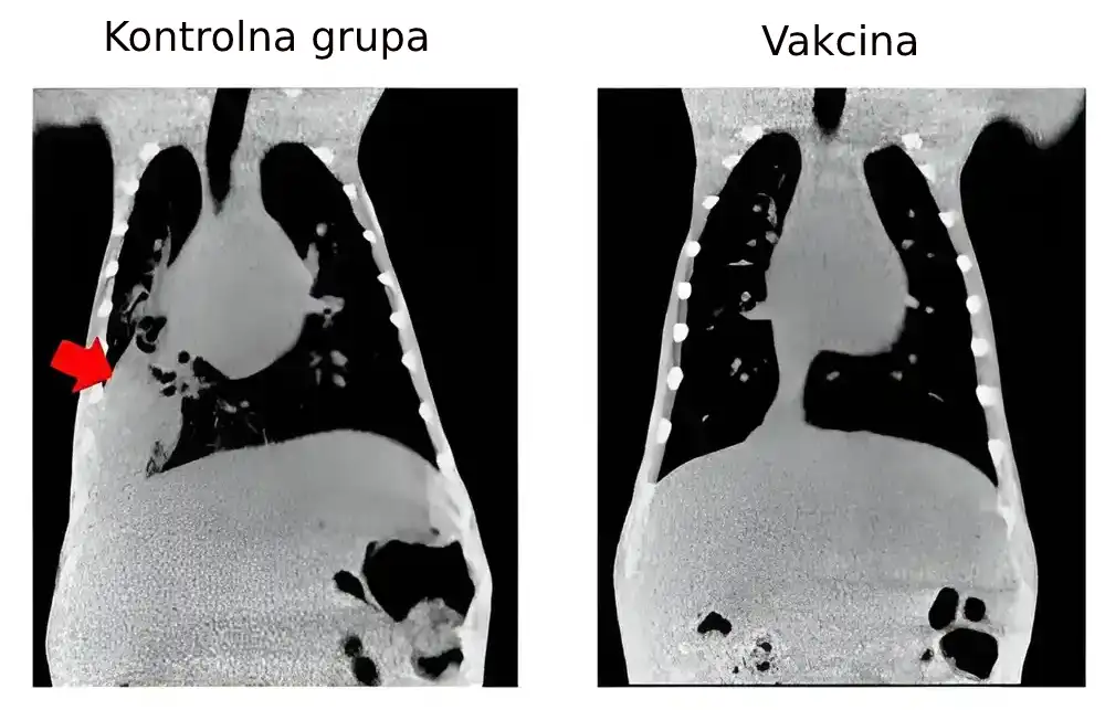 Ispitivanja makaka daju nadu u razvoj vakcine protiv pneumonije