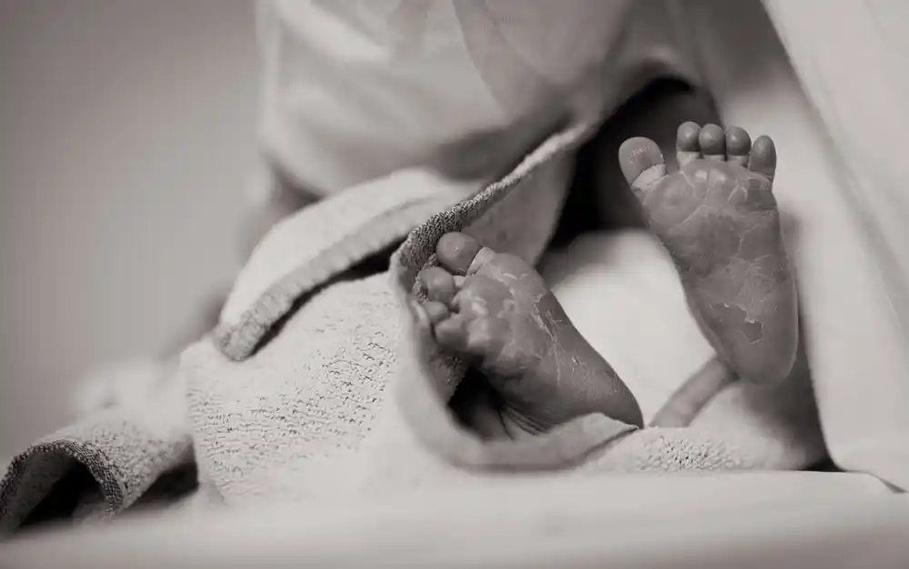 Ministarstvo zdravlja: Bebe preminule od velikog kašlja bile su koinficirane i drugim virusima