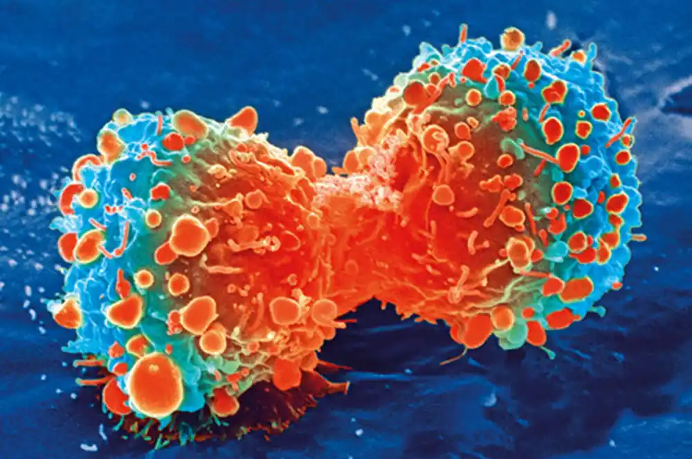 Dešifrovanje razgovora od ćelije do ćelije: AI predviđa odgovor imunoterapije protiv raka