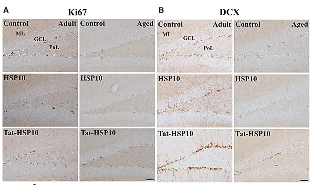 Tat-heat šok protein 10 poboljšava fenotipove povezane sa starenjem u hipokampusu