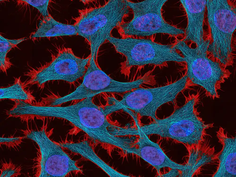 Istraživači prilagođavaju vrhunski metod mikroskopije sa AI da bi bolje razumeli tumore glioblastoma