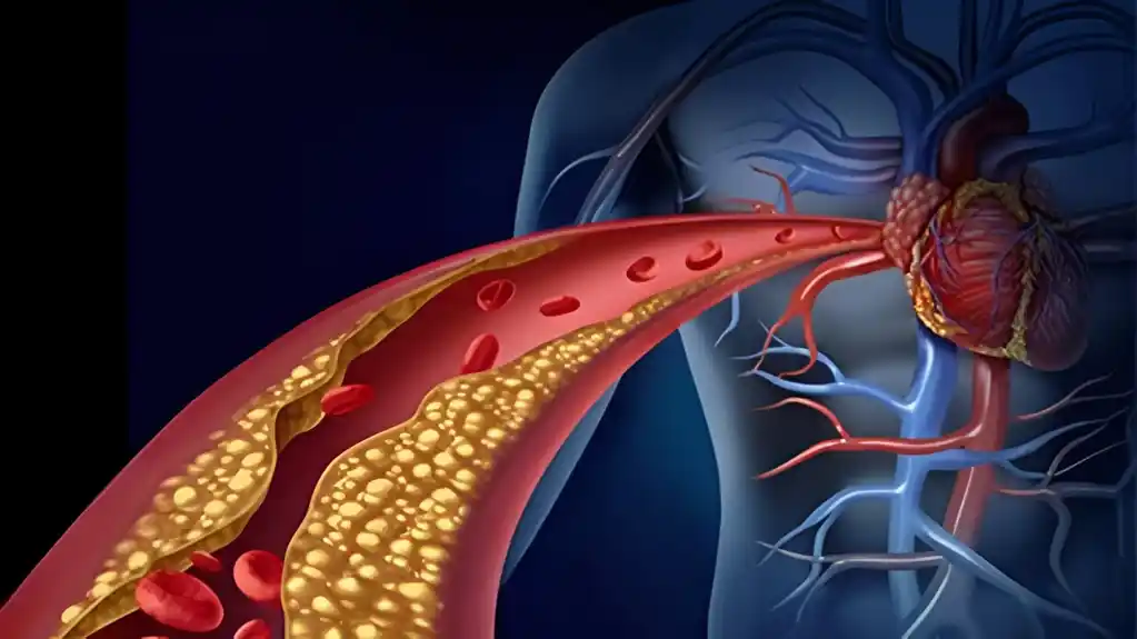 Nova studija razotkriva optimizovane strategije za hirurški postupak premosnice koronarne arterije