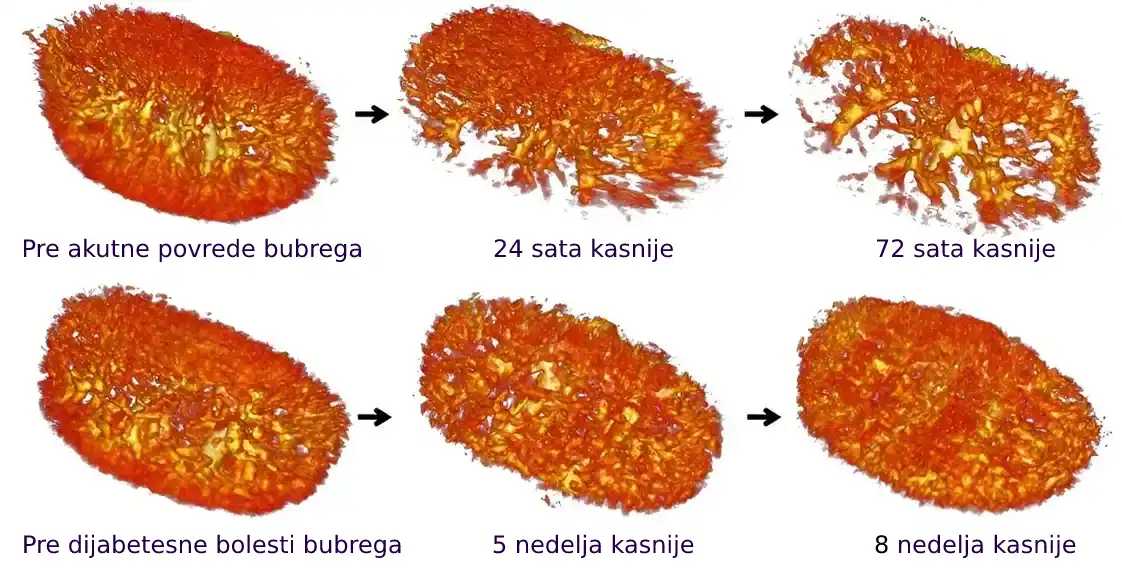 Ultrabrzi ultrazvuk: Prvo uspešno snimanje složene strukture bubrega bez kontrastnog sredstva