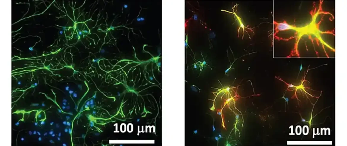 Revolucionaran pristup lečenju neurodegenerativnih bolesti putem inhibicije Keap1/Nrf2 interakcije