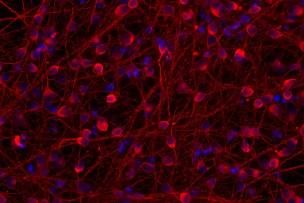 Istraživači hakuju unutrašnje satove neurona kako bi ubrzali proučavanje neuroloških bolesti