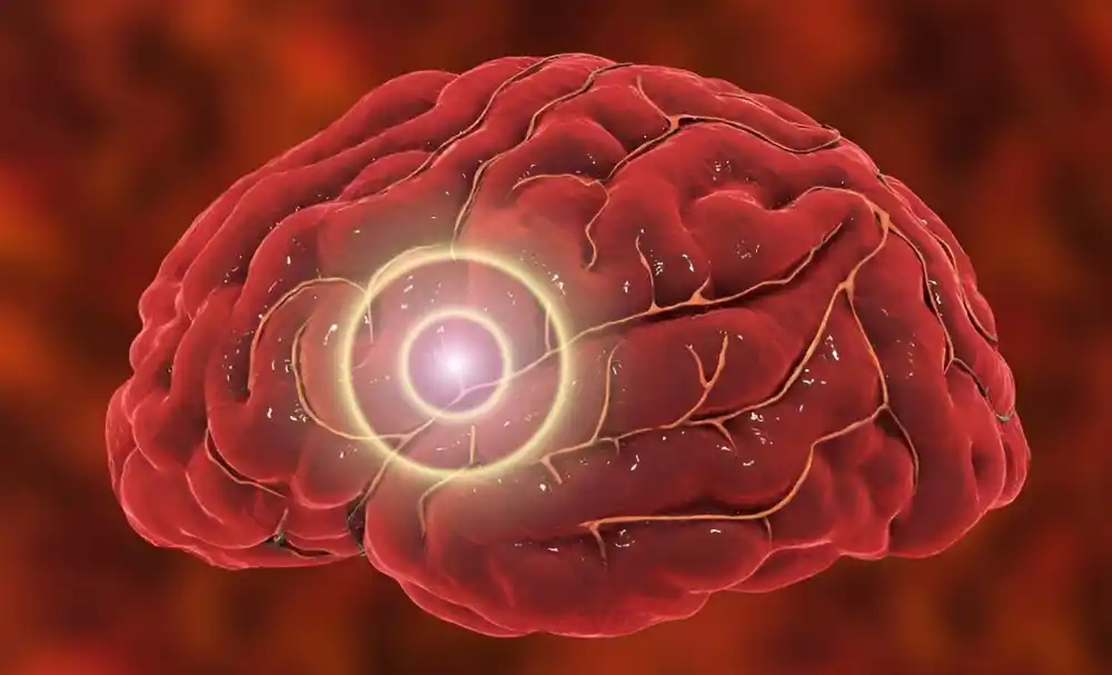 Studija pokazuje povezanost između traumatskih povreda mozga i raka mozga