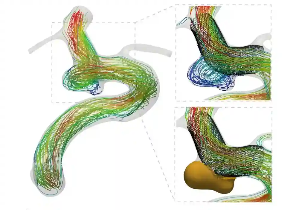 Napredak istraživanja otkriva bržu i precizniju simulaciju krvotoka za unapređenje lečenja vaskularnih bolesti