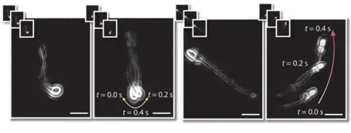 Ultrazvuk povećava pokretljivost ljudske sperme, pokazuje istraživanje