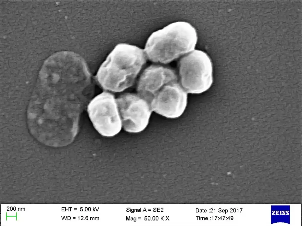 Generativna AI razvija potencijalne nove lekove za bakterije otporne na antibiotike