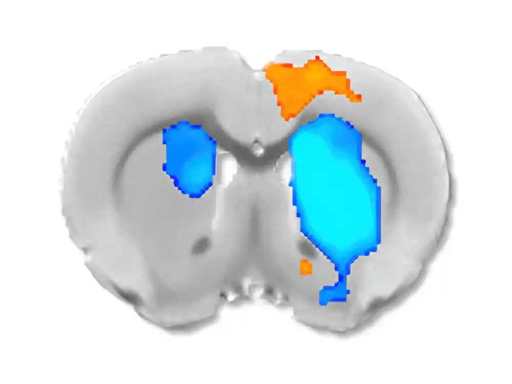 Nova studija pokazuje kako neurohemikalije utiču na očitavanja fMRI