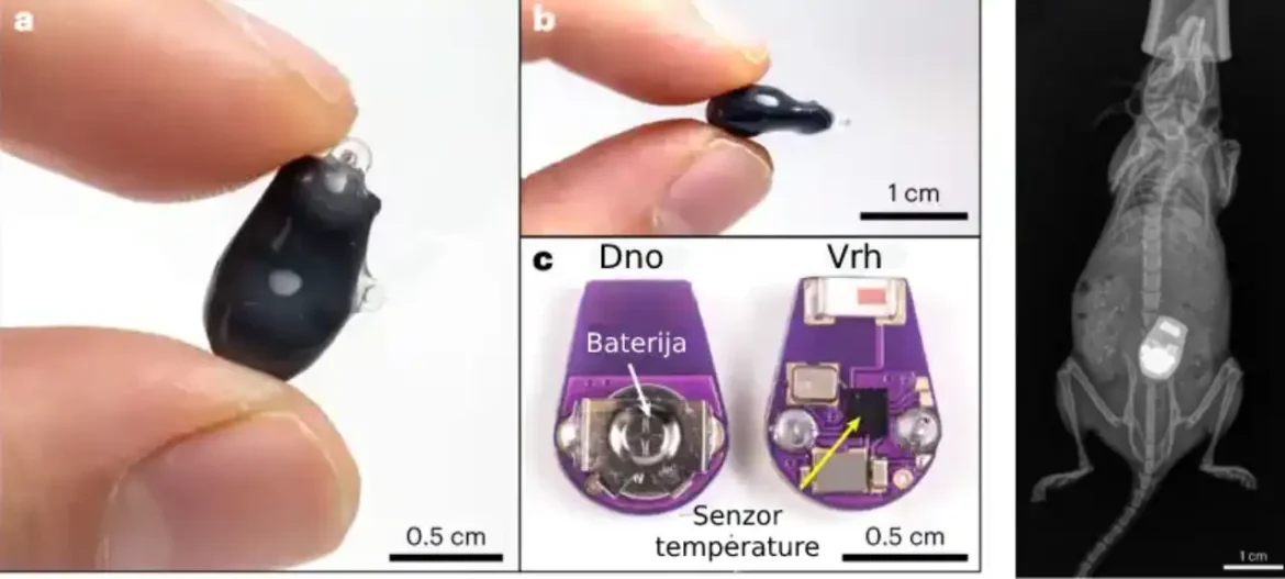 Senzor za implantaciju može dovesti do blagovremenog lečenja Krohnove bolesti