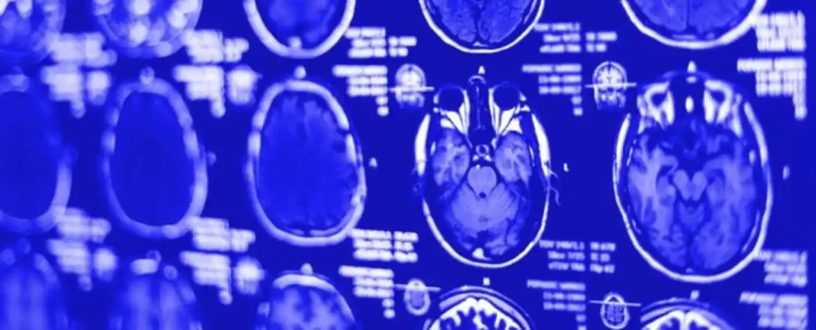 Stručnjak otkriva kako bi povremeni post mogao da utiče na vaš mozak