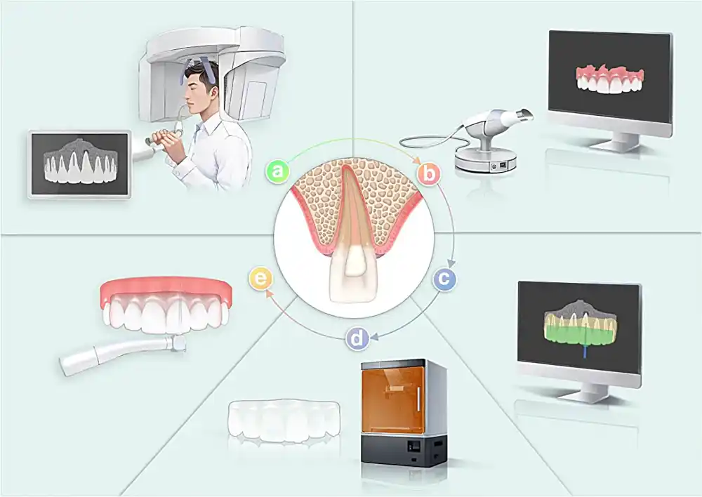 Transformisanje tretmana kanala korena: Uspon precizne stomatologije