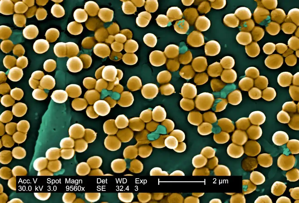 Infekcije nakon operacije su verovatnije zbog bakterija koje su već na vašoj koži nego od mikroba u bolnici