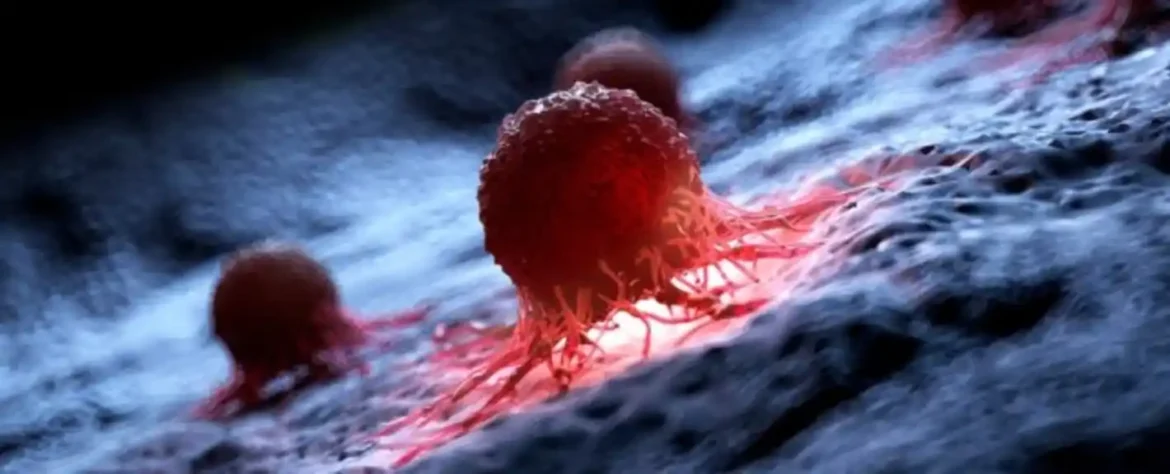 Interakcije ćelija raka i imunske ćelije mogu predvideti odgovor imunoterapije