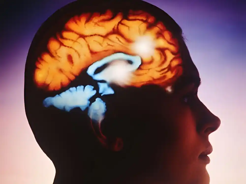 Nova studija sugeriše da ciljanje specifičnog dela mozga može pomoći u lečenju epilepsije