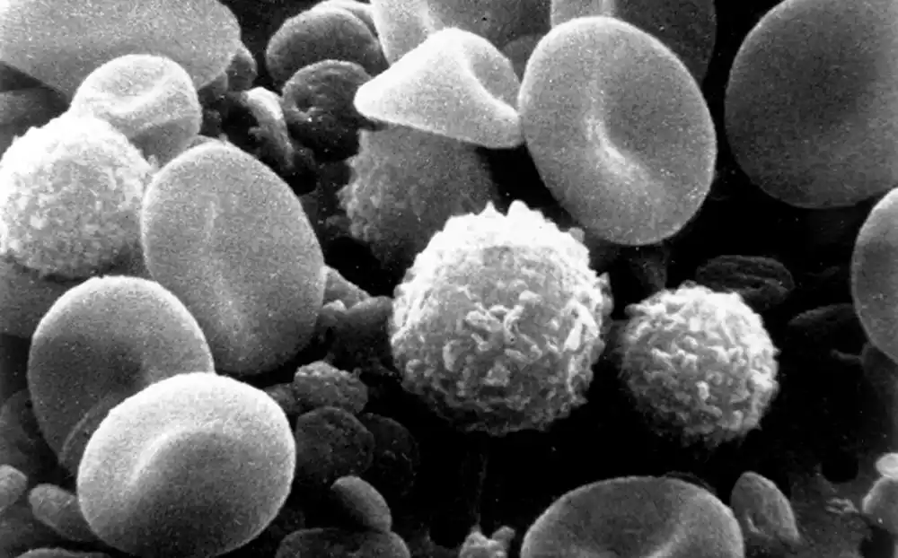 Otkrivene lažne imunološke ćelije koje mogu izazvati slab odgovor antitela kod hroničnih virusnih infekcija
