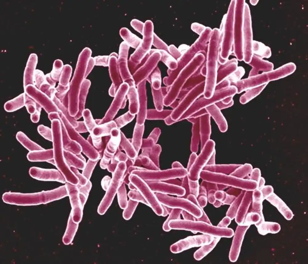 Model ljudske infekcije daje nadu za budući razvoj vakcine protiv TB