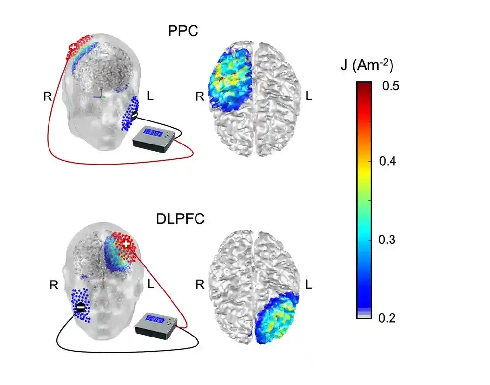 Studija dovodi u pitanje efikasnost stimulacije mozga za poboljšanje pamćenja