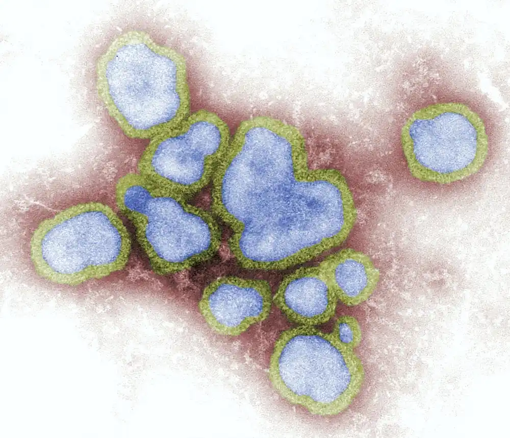 Studija pokazuje da je grip najzabrinjavajući patogen zbog potencijala pandemije