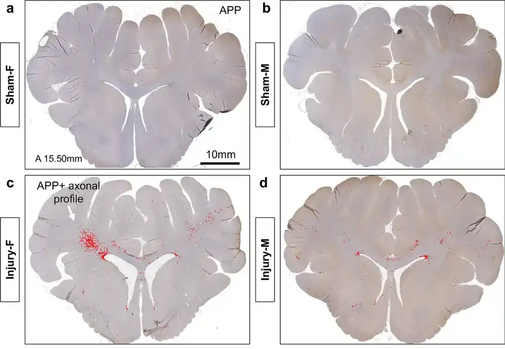 Aksoni u mozgu ženskih sisara mogu biti skloniji potresima mozga