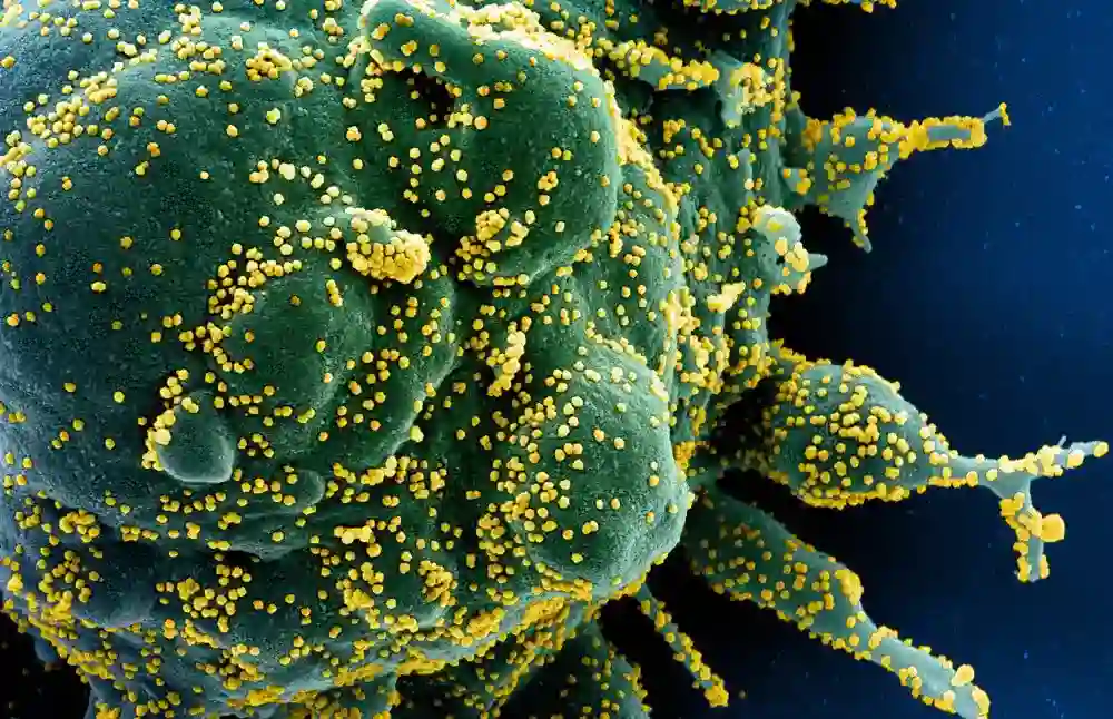 Kako infekcije COVID-19 menjaju vaše imune ćelije