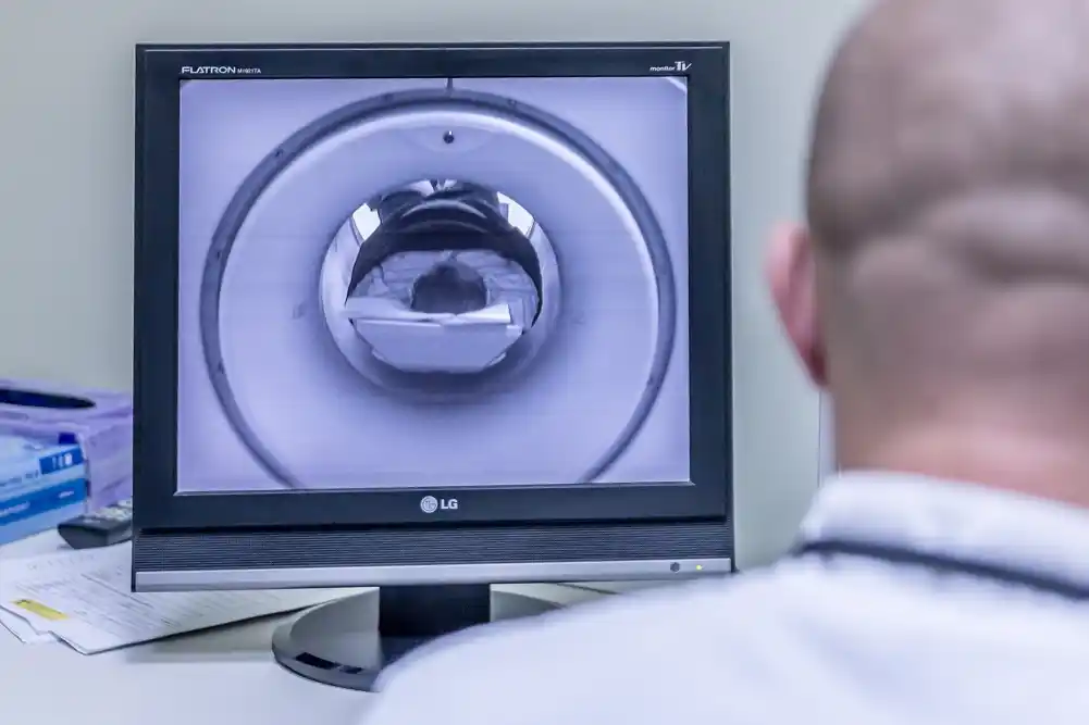 MRI u realnom vremenu otkriva obrasce pokreta unutrašnjih govornih mišića kod pacijenata koji mucaju