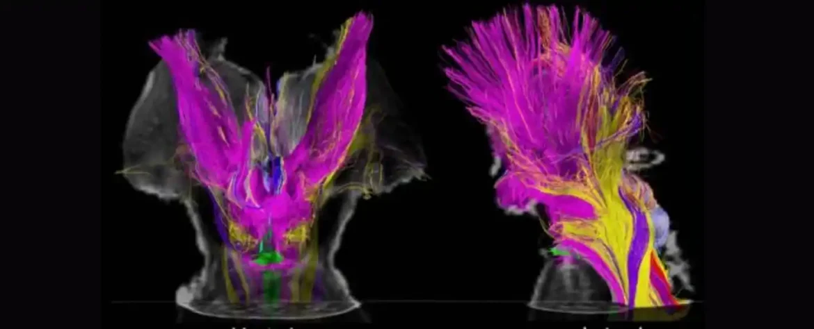 Na MR skeniranju, naučnici otkrivaju šta bi moglo da objasni izmenjena stanja svesti