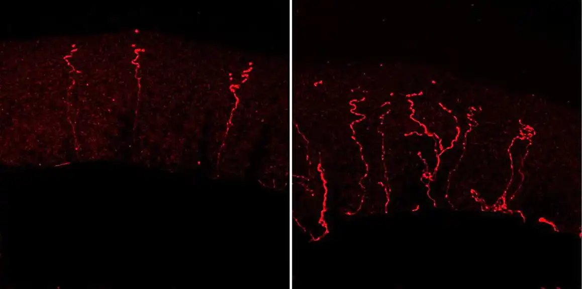 Istraživači otkrivaju protein koji menja nervne završetke, regulišući osetljivost na bol