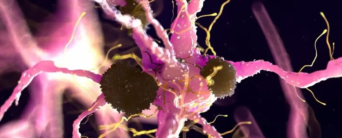 Odobreni lek protiv raka može usporiti Parkinsonovu bolest blokiranjem proteina Lag3