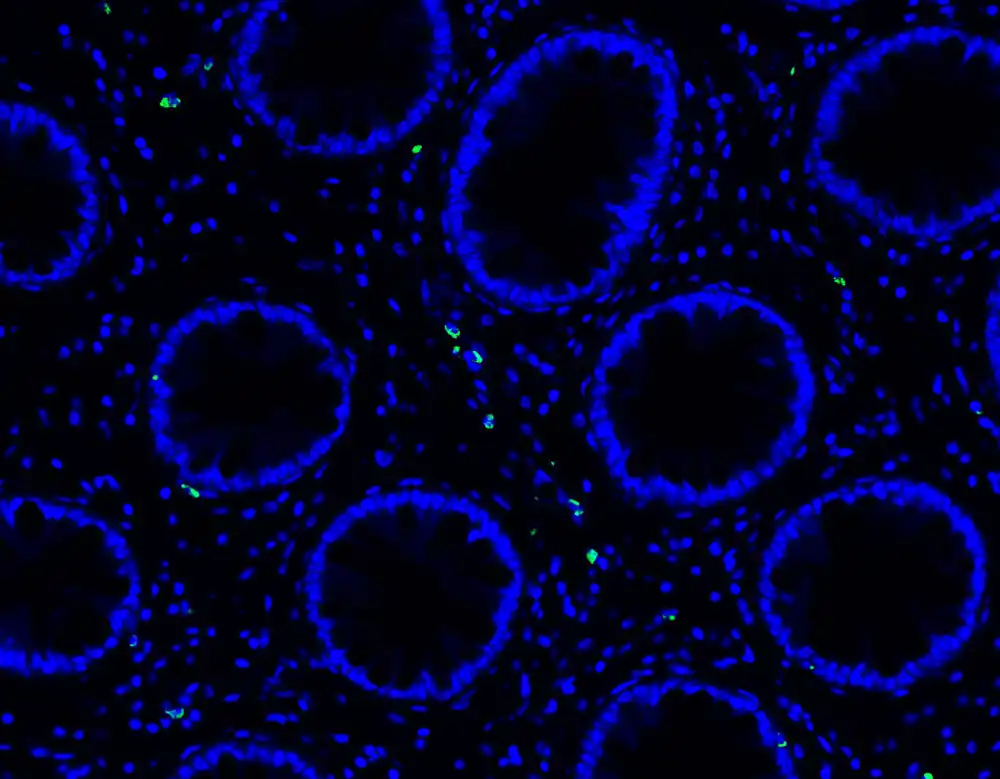 Duga nekarakteristična aktivnost imunoloških ćelija COVID-a i SARS-CoV-2 RNK pronađena u crevima