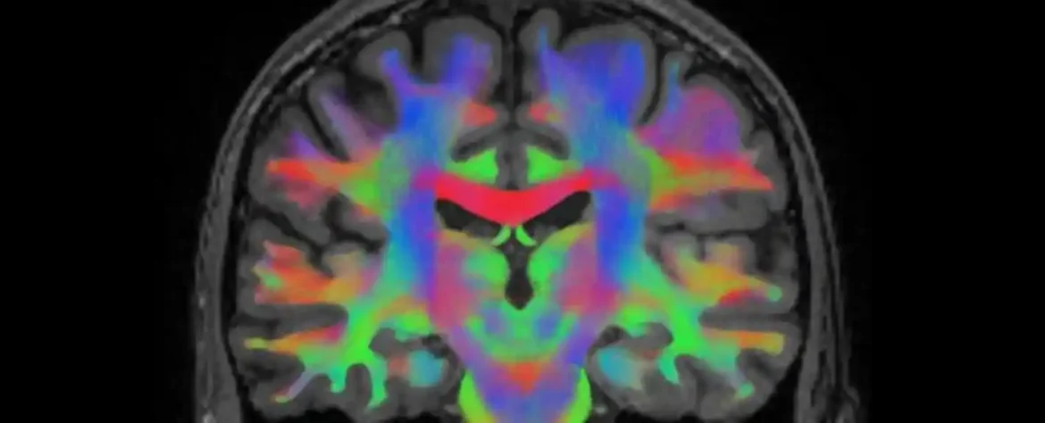 Naučnici otkrili moždano kolo koje bi mogao da objasni kako placebo ublažava bol