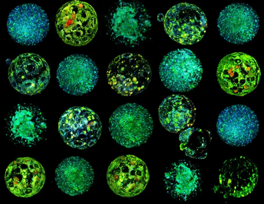 Nova tehnologija vizualizuje metabolizam embriona kako bi se poboljšao uspeh VTO-a