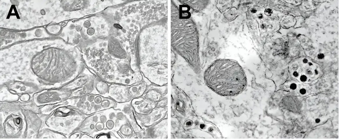 Novi alati otkrivaju neuropeptide, a ne neurotransmitere, koji kodiraju opasnost u mozgu