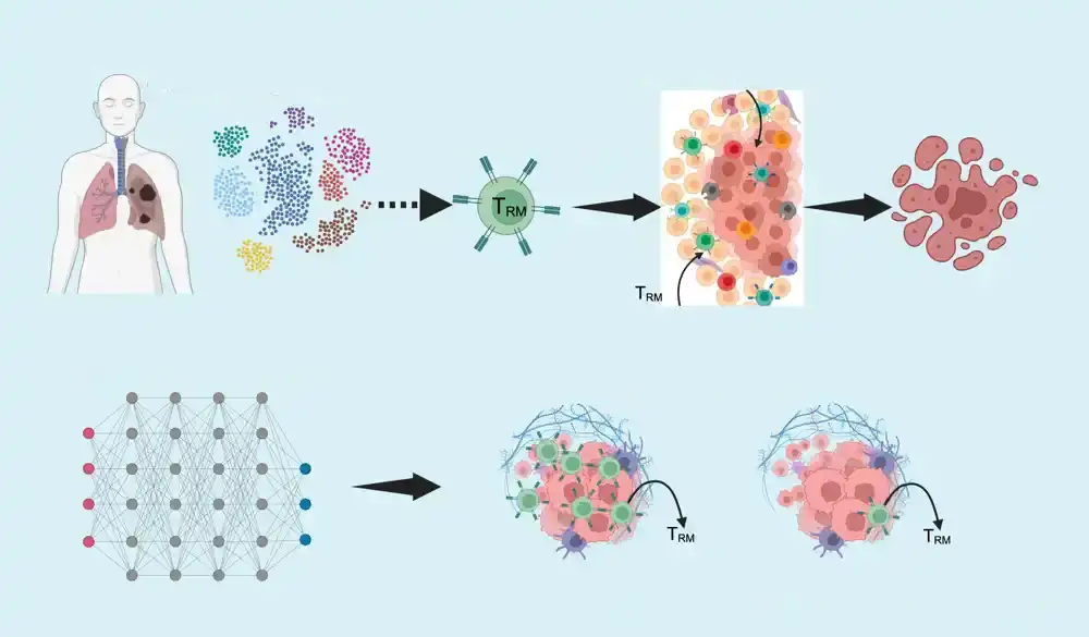 Nedavna studija otkriva ključne imune ćelije kao kritične faktore u prognozi raka pluća