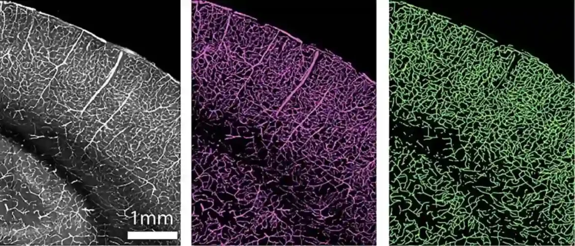Nove 3D mape visoke rezolucije pokazuju kako se krvni sudovi mozga menjaju sa godinama