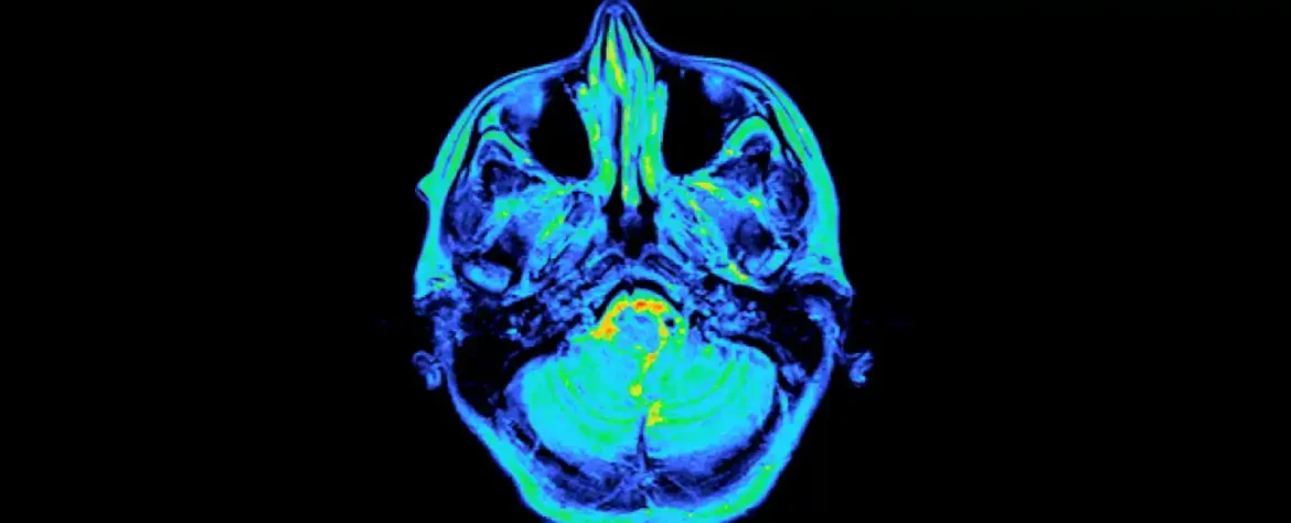 Prva detaljna mapa ljudskog mozga tokom trudnoće otkriva značajne neurološke promene