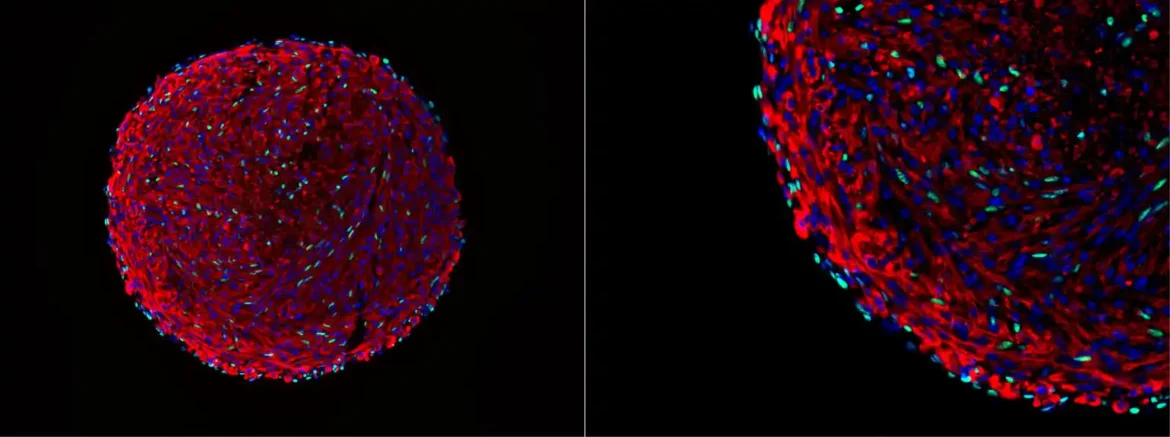 Metoda 3D organoidne kulture može da generiše veliki broj mišićnih ćelija in vitro