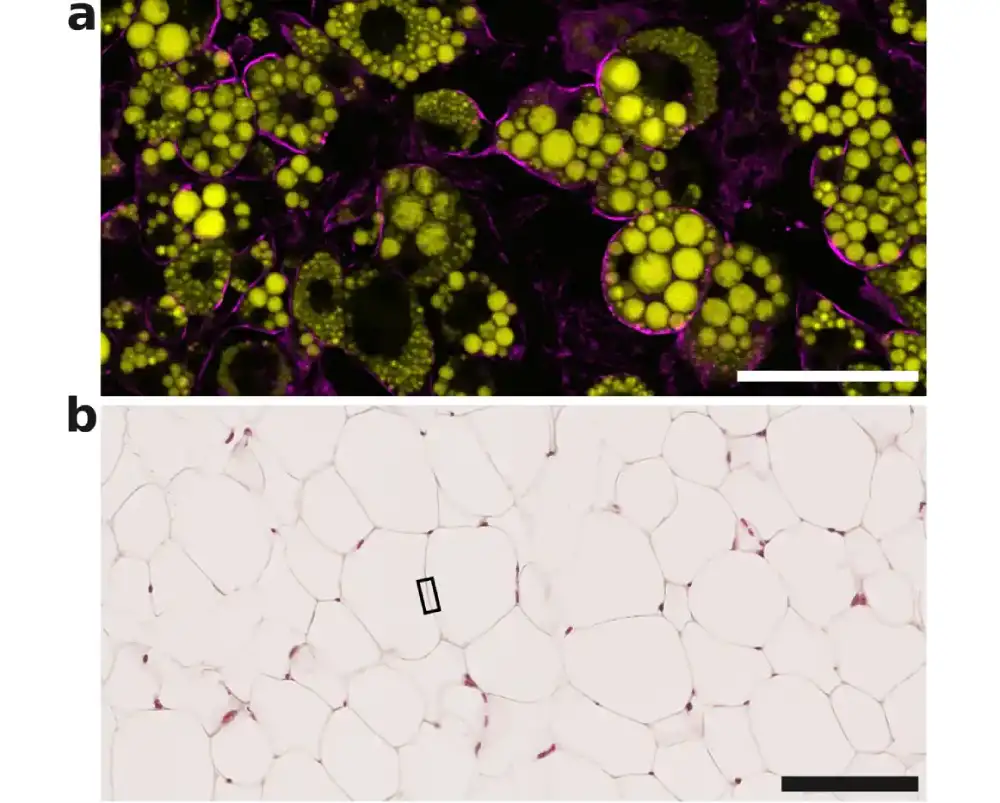 Tim otkriva da ključni mehanizam u masnim ćelijama štiti telo od viška energije